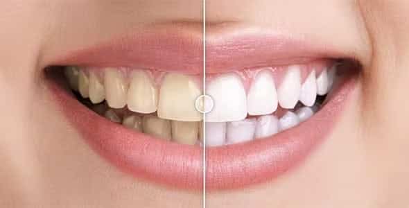 Before and After Images Comparison WordPress Plugin